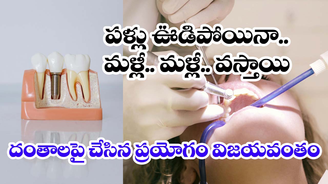Teeth”దంతాలు మ‌ళ్లీ మ‌ళ్లీ వ‌స్తాయి… లండ‌న్ సైంటిస్టులు అద్బుత సృష్టి. వీడియో